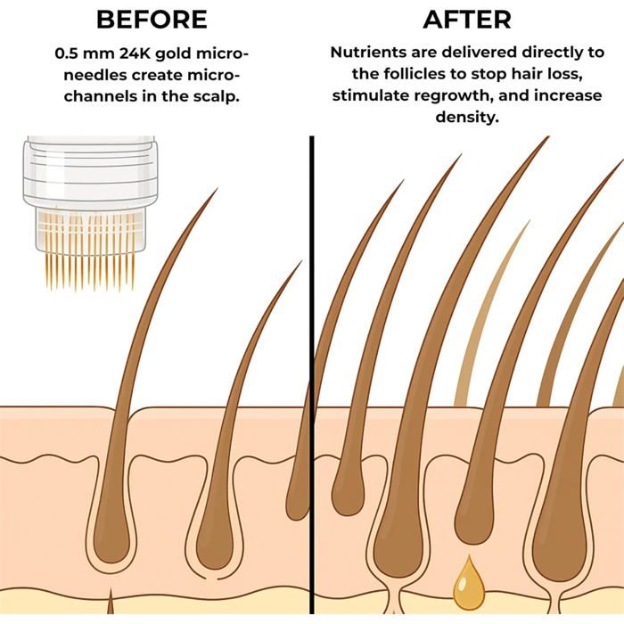 Reverse Hair Thinning,